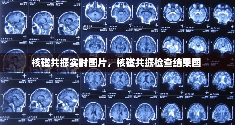 核磁共振实时图片,核磁共振检查结果图