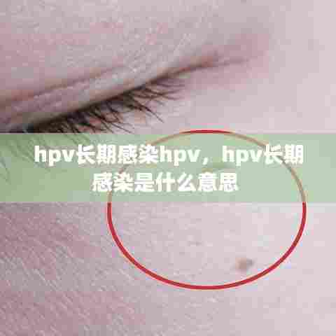 hpv长期感染hpv，hpv长期感染是什么意思 