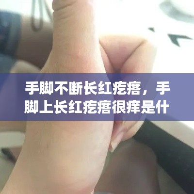 手脚不断长红疙瘩,手脚上长红疙瘩很痒是什么