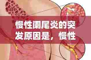 慢性阑尾炎的突发原因是,慢性阑尾炎引发并发症