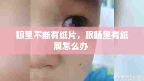 眼里不断有纸片,眼睛里有纸屑怎么办
