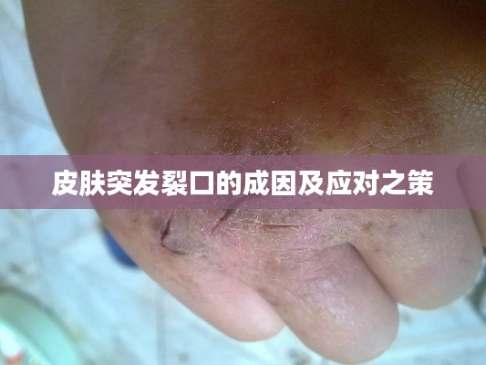 皮肤突发裂口的成因及应对之策