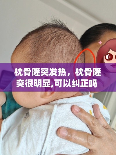 枕骨隆突发热,枕骨隆突很明显,可以纠正吗
