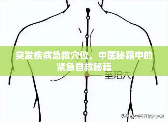 突发疾病急救穴位,中医秘籍中的紧急自救秘籍