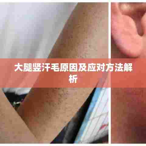 大腿竖汗毛原因及应对方法解析