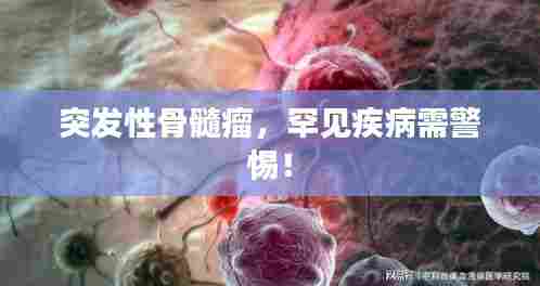 突发性骨髓瘤,罕见疾病需警惕!